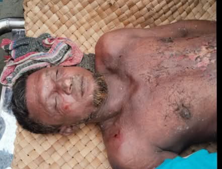 গলাচিপায় বজ্রপাতে কৃষকের মৃত্যু