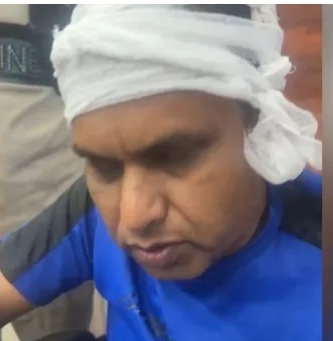 খুলনায় খাদ্য কর্মকর্তাকে কুপিয়ে জখম