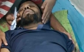 খুলনায় দুর্বৃত্তের হাতুড়ি পেটায় শ্রমিকদল নেতা আহত